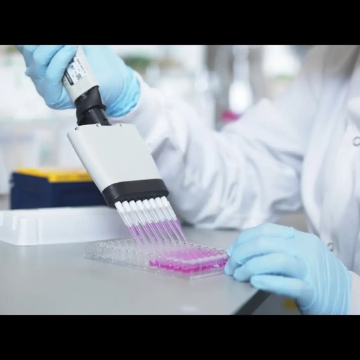 [AE25991BO] Bovine CAMP dependent protein kinase type II alpha regulatory subunit (PRKAR2A) ELISA Kit